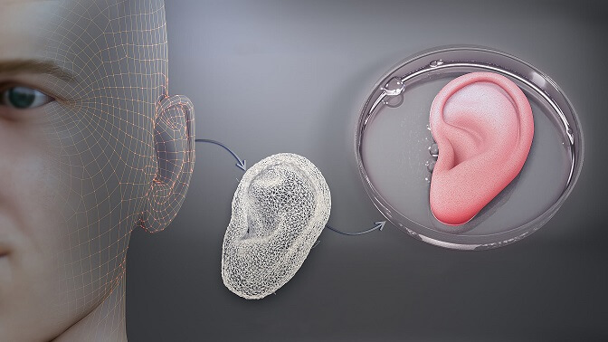 3d printing used in healthcare
